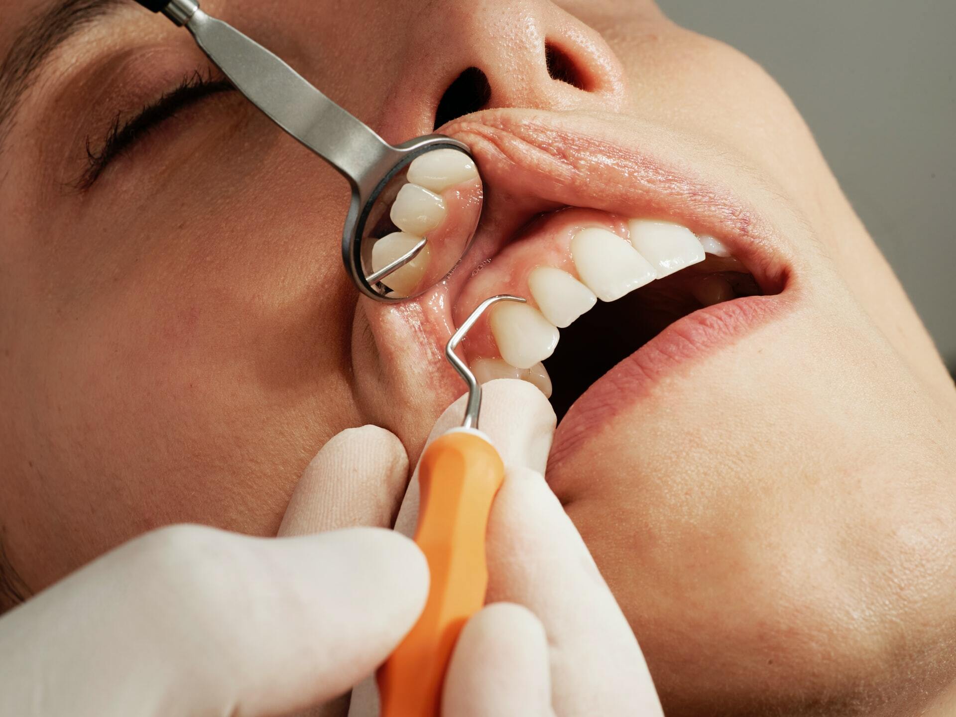 What You Need to Know Before Getting Dental Implants 5 caroline lm 8BkF0sTC6Uo unsplash