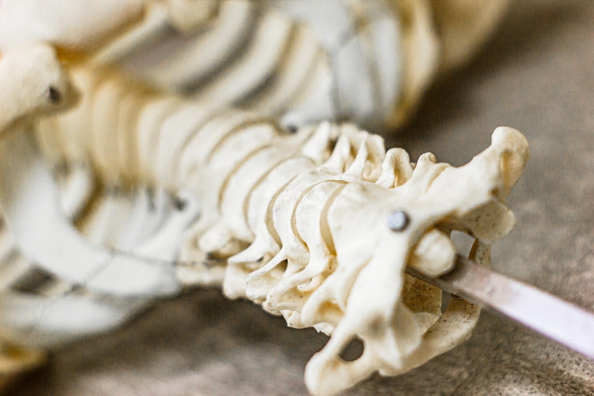 Why Spine Health Matters 5 spine