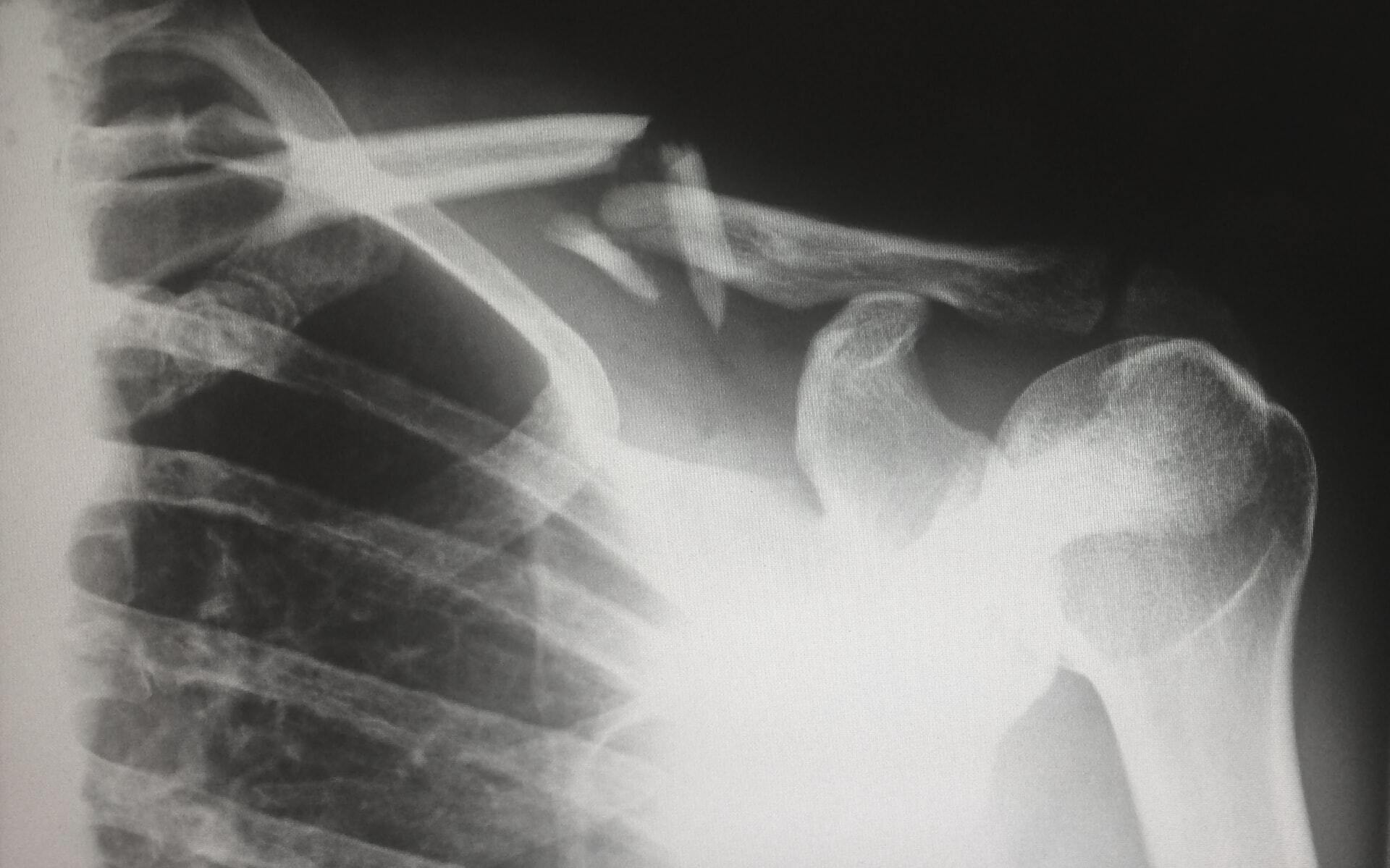 What to Do if Someone Is Injured at Your Sports and Fitness Center 5 injured